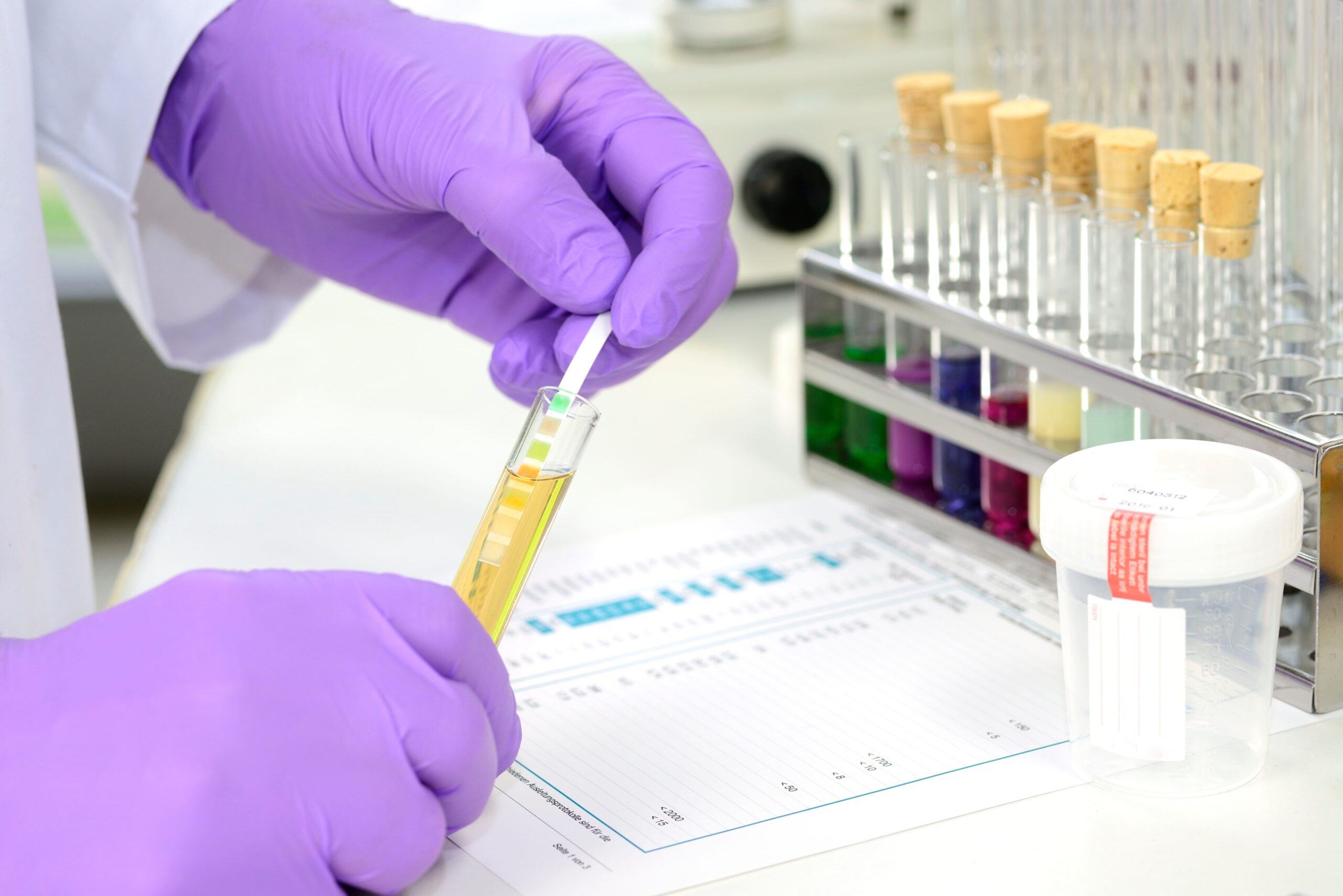 Tests antidrogue en entreprise : pour qui et dans quelles conditions ?