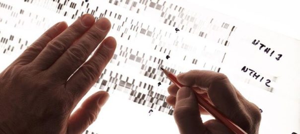 Un polymorphisme du récepteur GABA-B est associé à une meilleure réponse au baclofène dans le trouble d’usage d’alcool, une étude publiée dans Addiction.