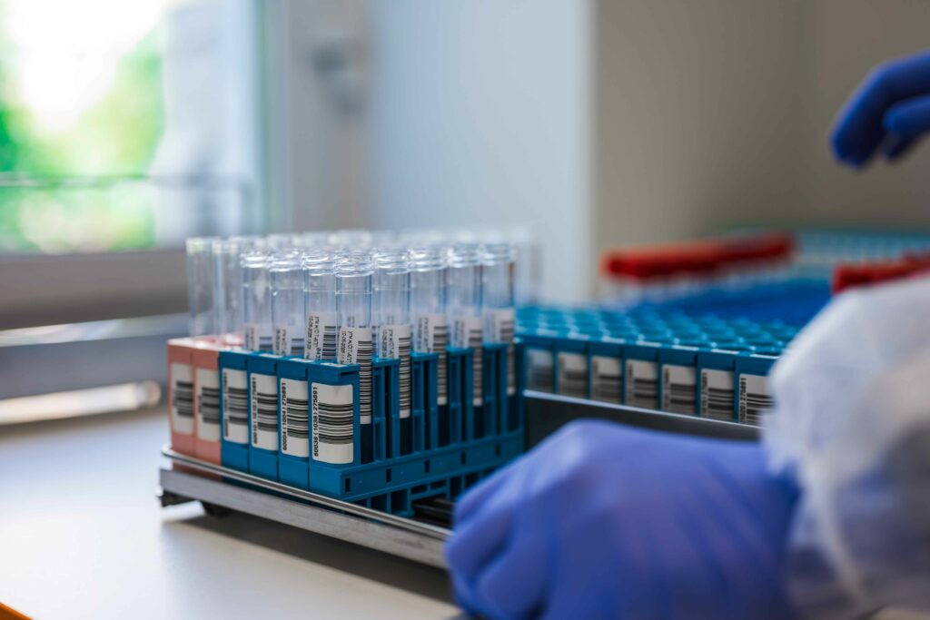 Et si les biomarqueurs révolutionnaient le dépistage du cancer du poumon